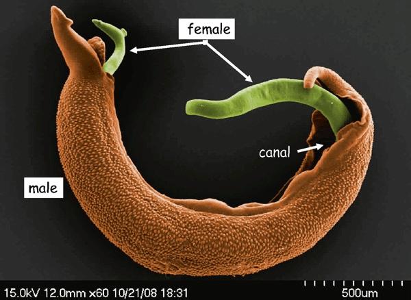 可以在人体寄生的海洋寄生虫,血吸虫寄生人体雌虫多久会产卵
