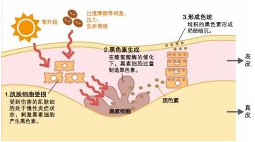肤色一黑一白怎么办,肤色黑可以美白吗