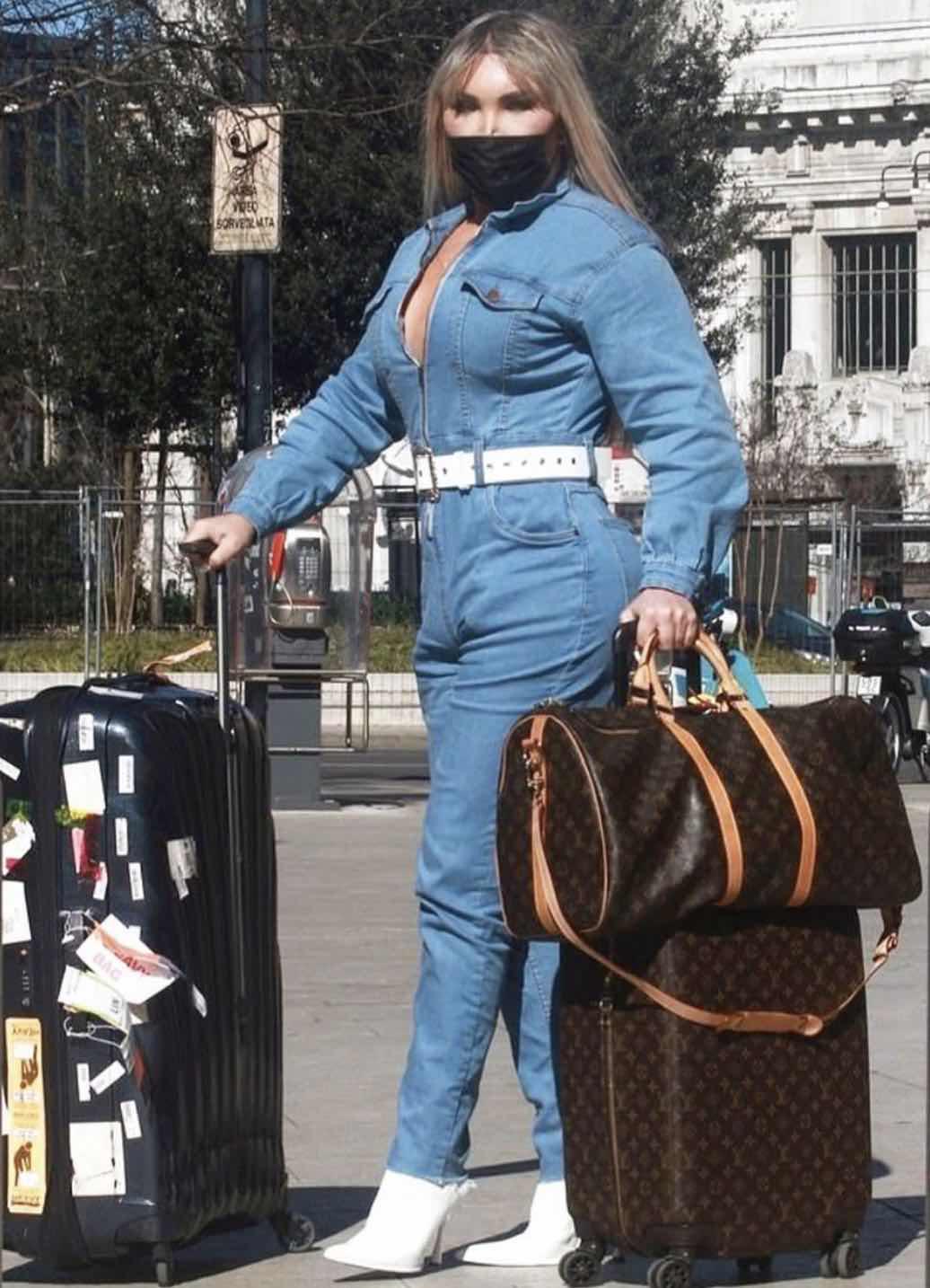 巴西男整容42次图片,巴西男模花数百万整容