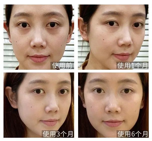 眼霜推荐去细纹黑眼圈平价,自己用过的一款眼霜推荐给大家