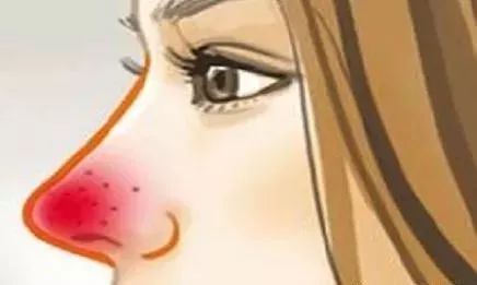 哪些问题属于内分泌失调,肠道菌群失调与甲状腺疾病有关