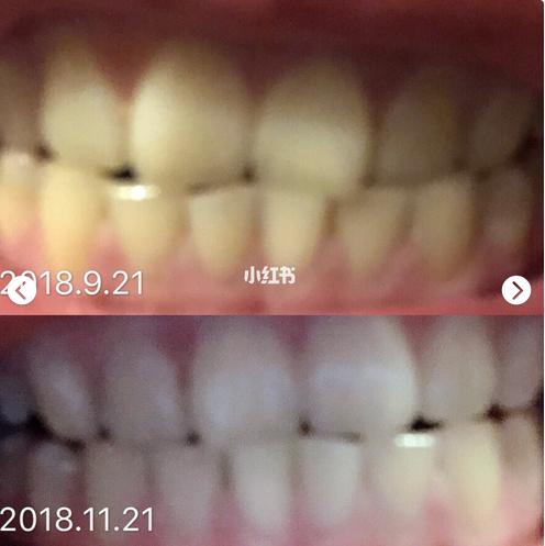 用过哪些口腔护理的好物,超实用的平价口腔护理推荐