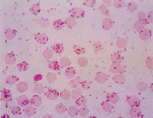 预防猪的附红体用什么药,治疗猪附红体特效药