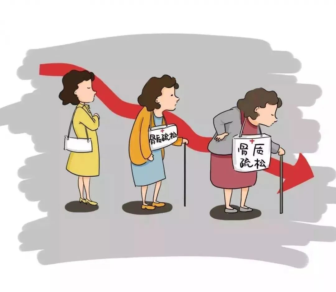 绝经后女性雌激素缺乏有哪些症状,女人绝经晚是什么原因