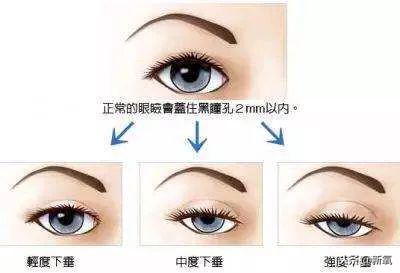 辛芷蕾是苦相女生吗,辛芷蕾气质怎么养成