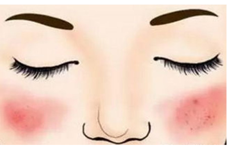 角质薄的人真的伤不起，换季护肤有何要注意的地方？