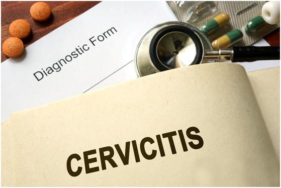 宫颈炎症严重会引起病变吗,宫颈炎症严重会引起宫颈癌吗