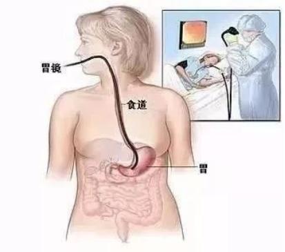 胃肠镜检查前后准备和注意事项,胃肠镜检查流程详解