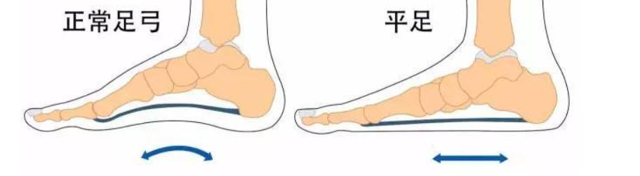 如何正确的瘦小腿,如何一周内快速瘦小腿