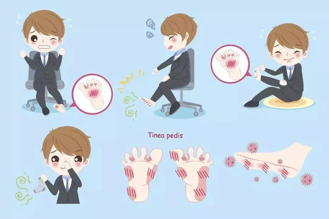 脚气，那是一种什么感觉？