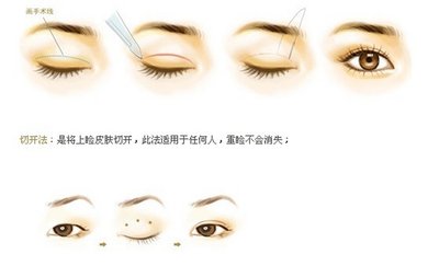单眼皮的小姐姐,单眼皮怎么贴成欧式大双眼皮