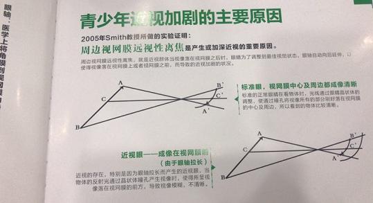 优倍视——专注青少年儿童近弱视防控，许昌店提供优质服务