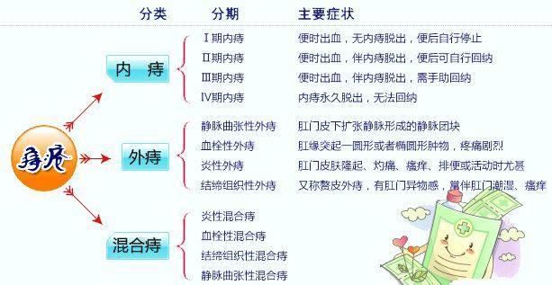 痔疮脱出3cm一般多久可以自愈,痔疮脱出肉球疼痛最佳的自愈方法