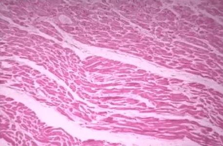 83天核事故救治纪录片,核灾83天死亡全记录