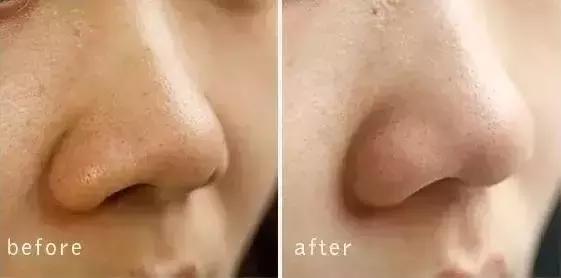 护肤太多的坏处有哪些呢,护肤越补越糟糕