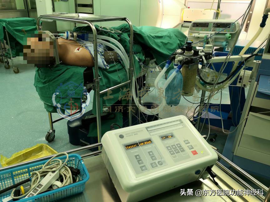 服用抗精神病药物副作用多，看手术如何破解治疗之困境