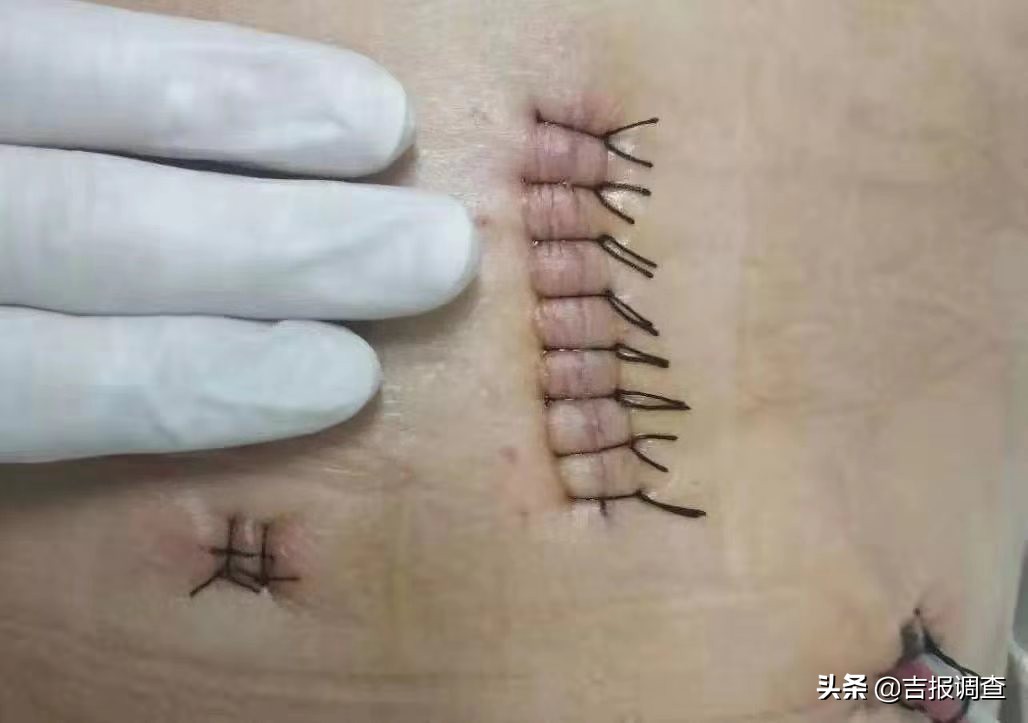 吉林国文医院介入科,吉林省国文医院