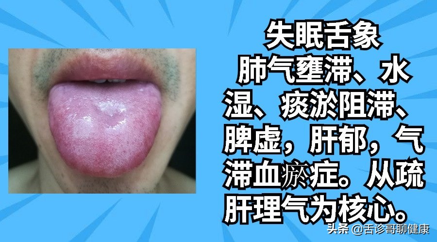 舌诊哥聊血瘀,舌诊哥聊健康痰湿
