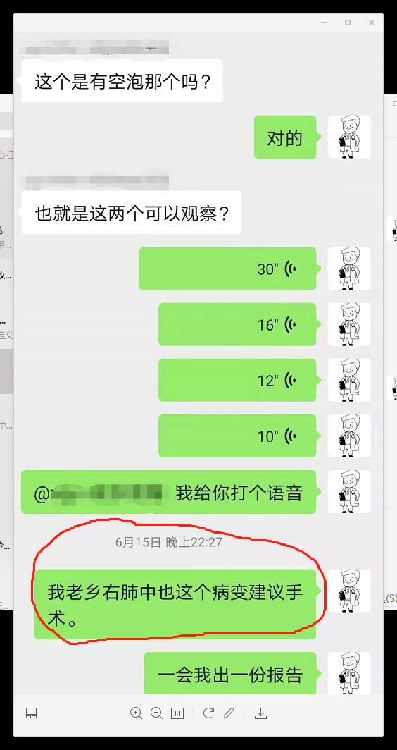 肺结节看诊（七）：这个肺结节手术太及时，空泡征小结节要注意