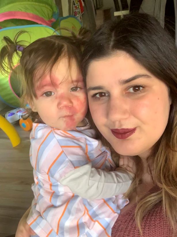 澳洲女孩被人打,澳洲女孩被打