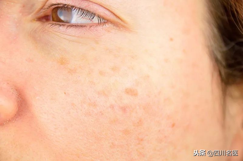 华佗国药祛斑丸是真的吗,华佗祛斑美白产品