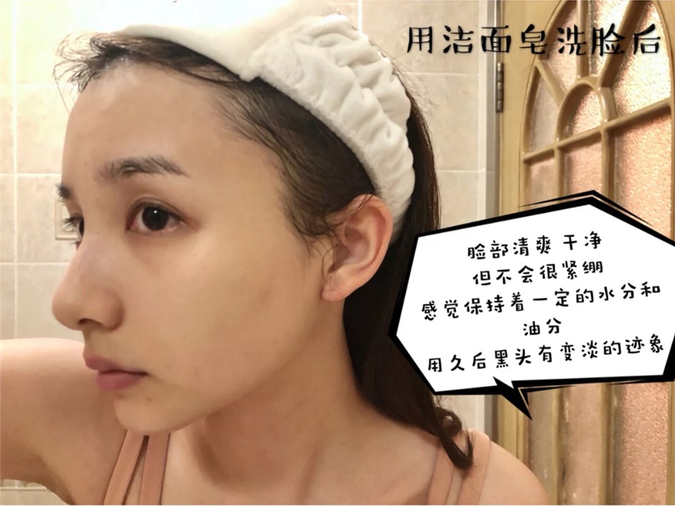 赵丽颖皮肤毛孔粗大图片,赵丽颖无美颜无滤镜最真实的模样