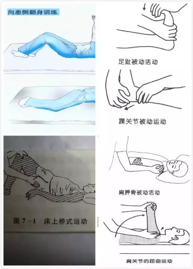 医生详细图文演示:脑卒中患者各阶段康复治疗方案,建议收藏!