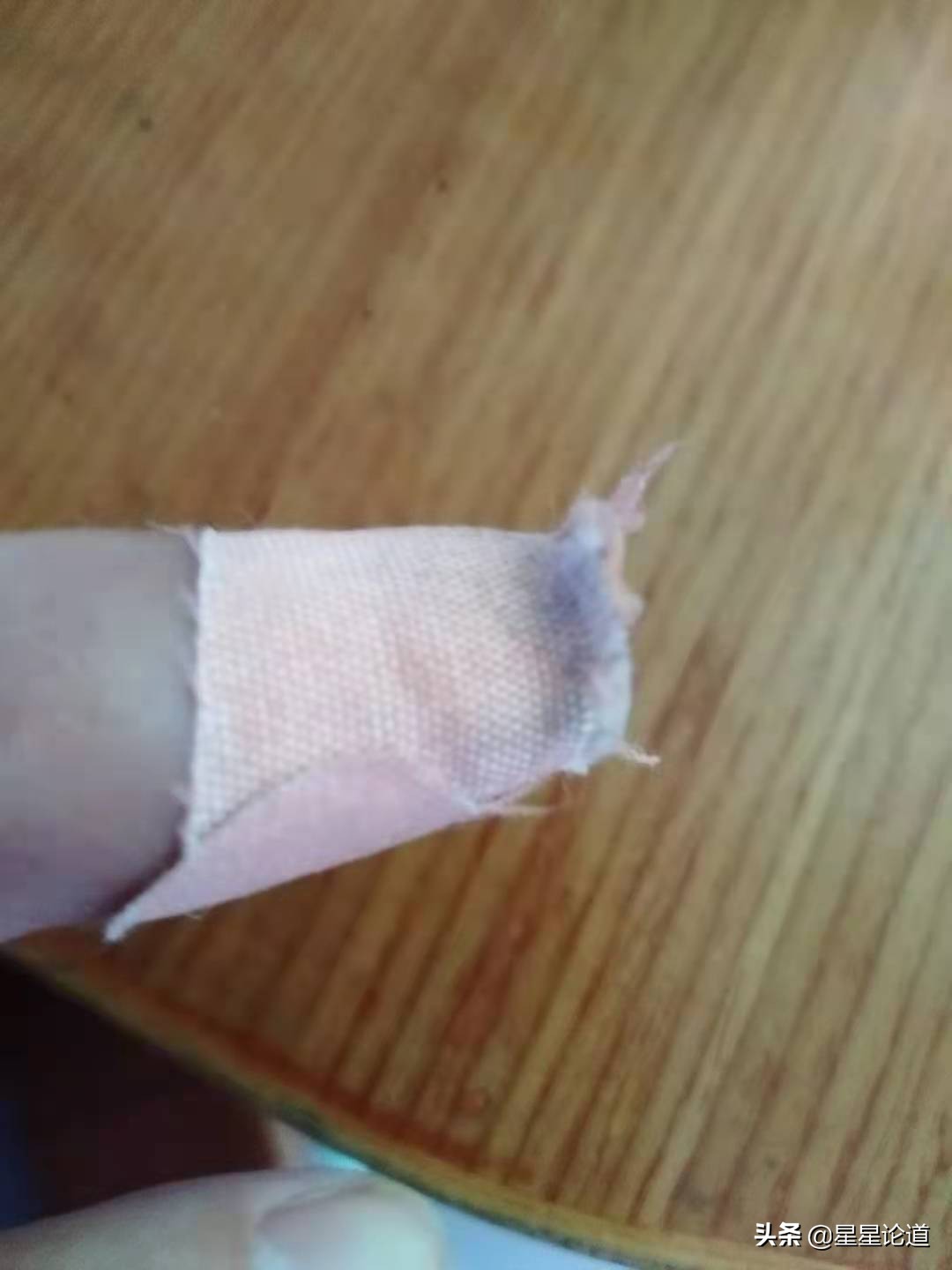 指甲盖劈了怎么办,指甲盖剪破了怎么办