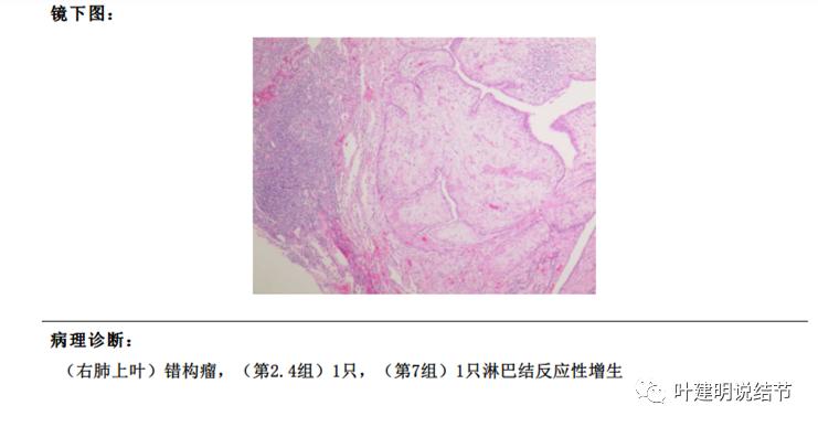 误诊报告图片,误诊案例及案例分析