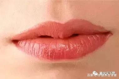 皱纹变多的症状,最近为什么突然有皱纹了