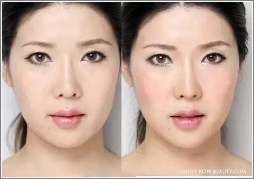 网红鼻子变挺的方法,网红鼻影真实效果