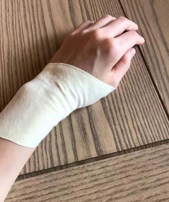 妈妈手如何恢复健康,妈妈手怎么处理