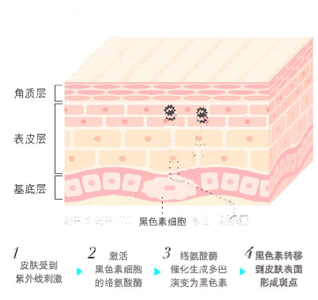 靠“副作用”上位的美白新贵——氨甲环酸到底有多神奇