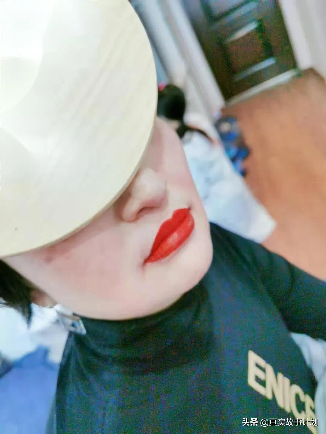 60岁皮肤松弛切眉整形,中老年脸部除皱纹整容手术