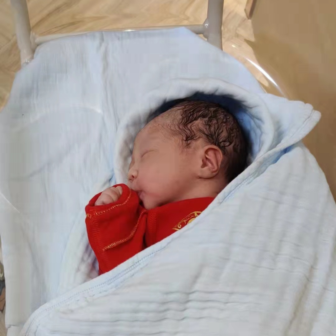 陪产爸爸的纪念：肚子上青紫的掐痕好几个月褪不掉