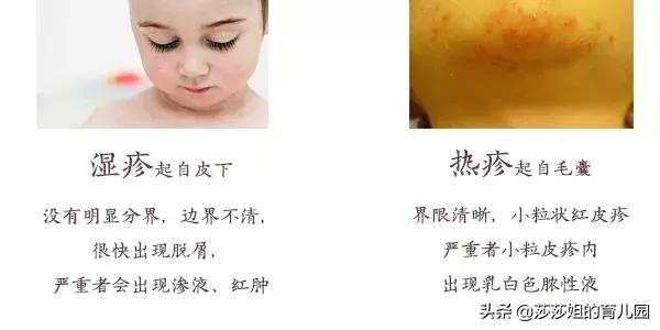 宝宝长湿疹怎么祛湿,婴儿祛湿疹止痒最快的偏方