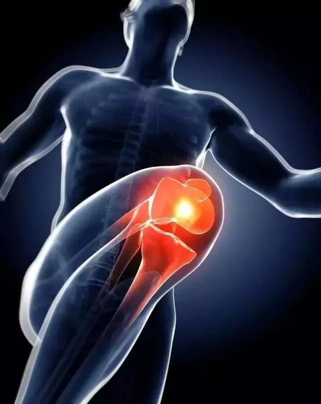 健身时关节有异响还能继续运动吗,训练时关节为什么会响