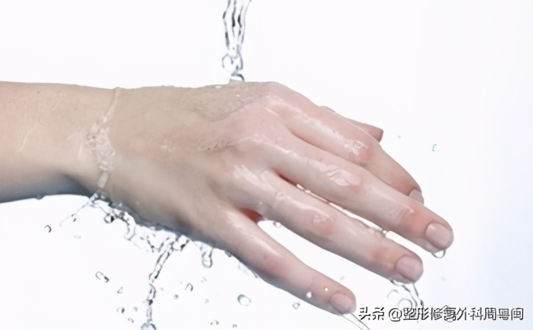 烧烫伤后如何止痒,烧烫伤后的局部处理