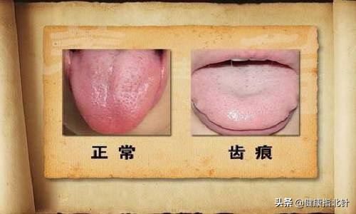 一招教你看舌苔6种舌苔你是哪种,身体好不好看嘴唇就知道了