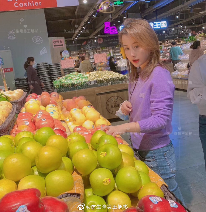 假体隆鼻耳软骨垫鼻尖图片,l型假体耳软骨隆鼻图片