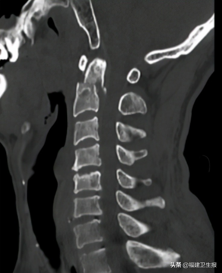 娉夊窞绗竴鍖婚櫌棰堟鎵嬫湳,娉夊窞鍖婚櫌棰堟寰垱