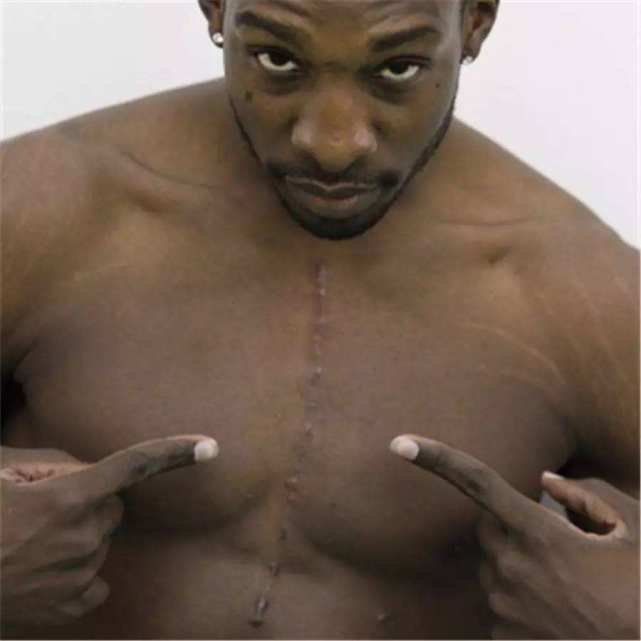 罗斯的脚趾,罗斯的膝盖是怎么样的