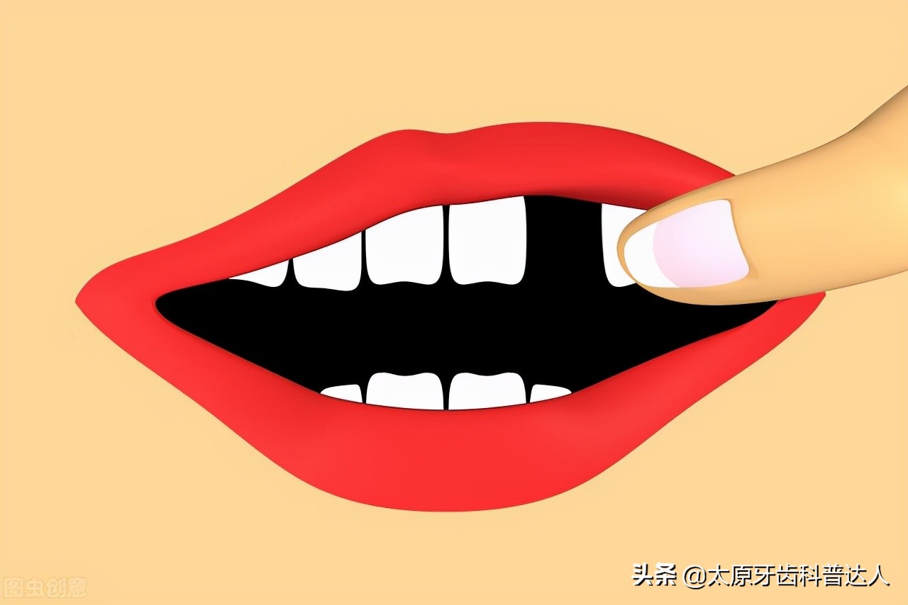 儿童牙齿摔掉了怎么处理最好,牙龈萎缩导致牙齿脱落怎么办