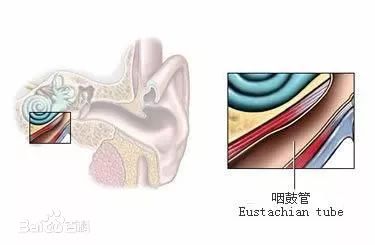 耳朵游泳进水嗡嗡响出不来,耳朵进水后像堵了一层膜听不清