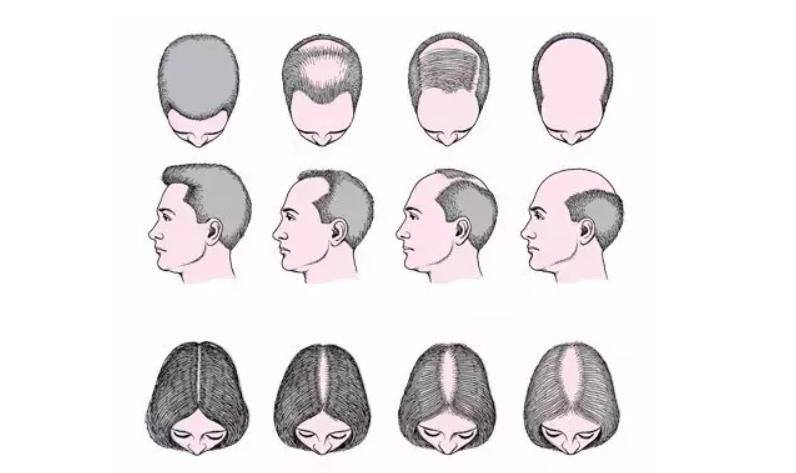 清朝解决秃发,清朝秃发怎么办