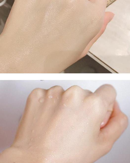 闭口粉刺怎么导致的,闭口粉刺和闭口的区别