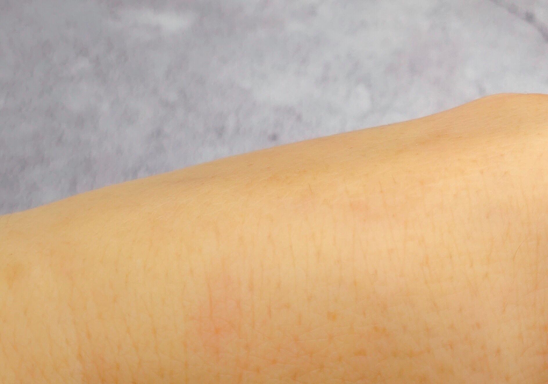 ulike脱毛仪多少钱一台,ulikerose脱毛仪