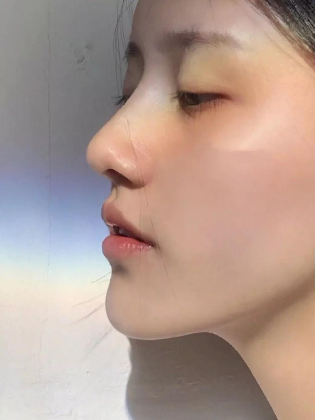 膨体材料真的很难取吗,膨体怎么取出来