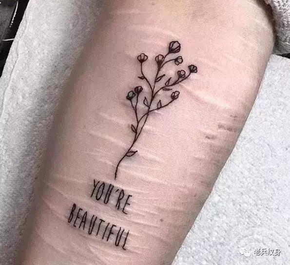 疤痕体质可以用纹身去遮盖疤痕吗,你的疤痕是什么颜色呢