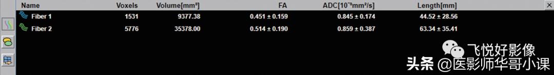 飞利浦磁共振波谱成像扫描技术,飞利浦磁共振纵隔扫描技术